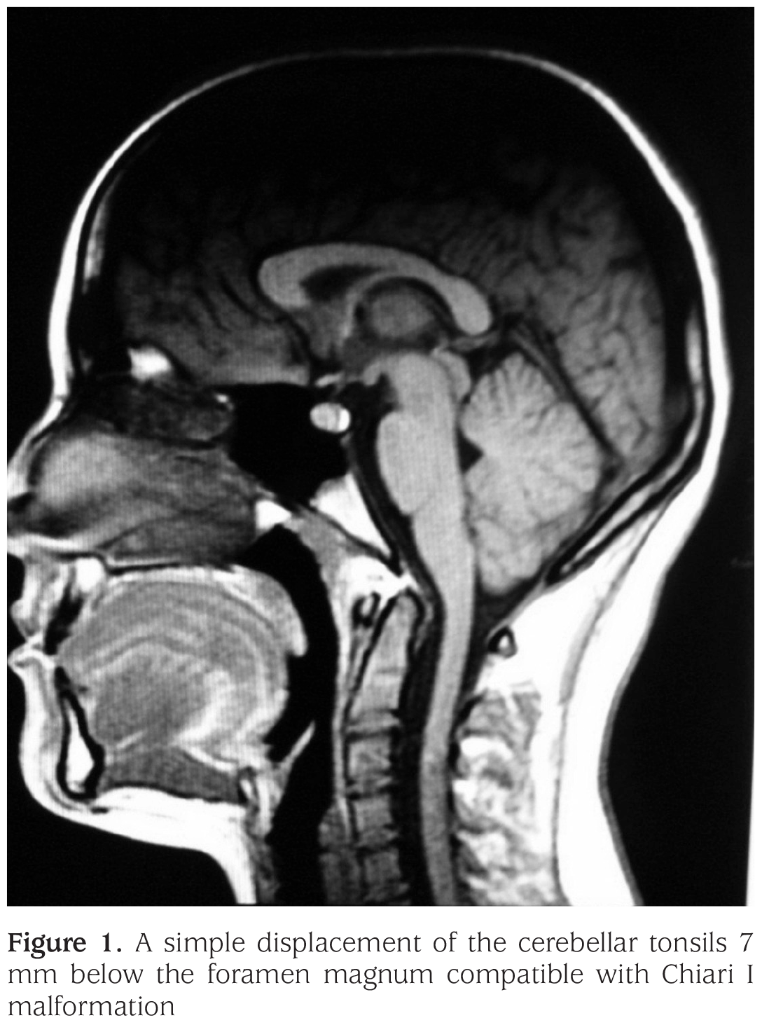 Figure 1