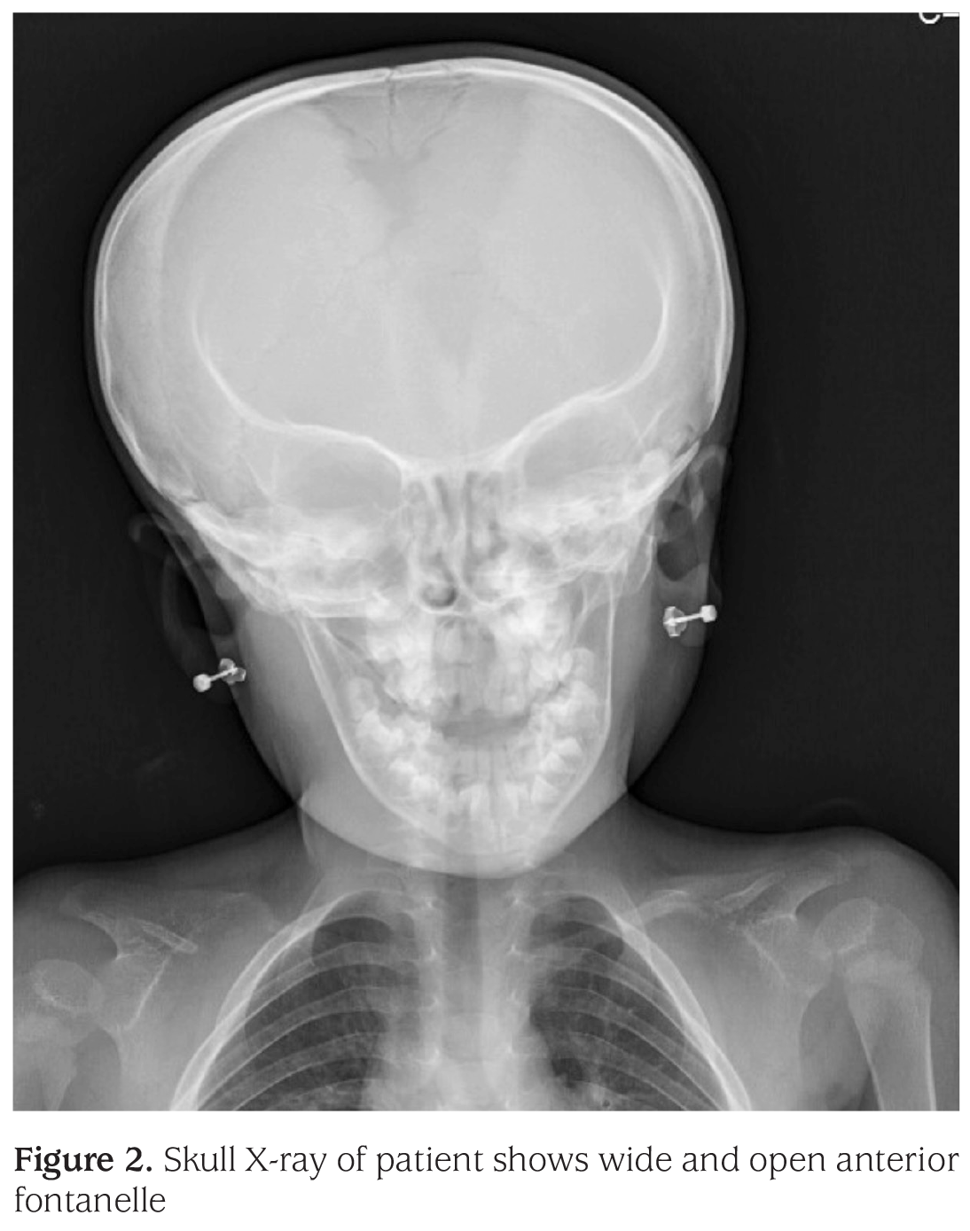 Figure 2