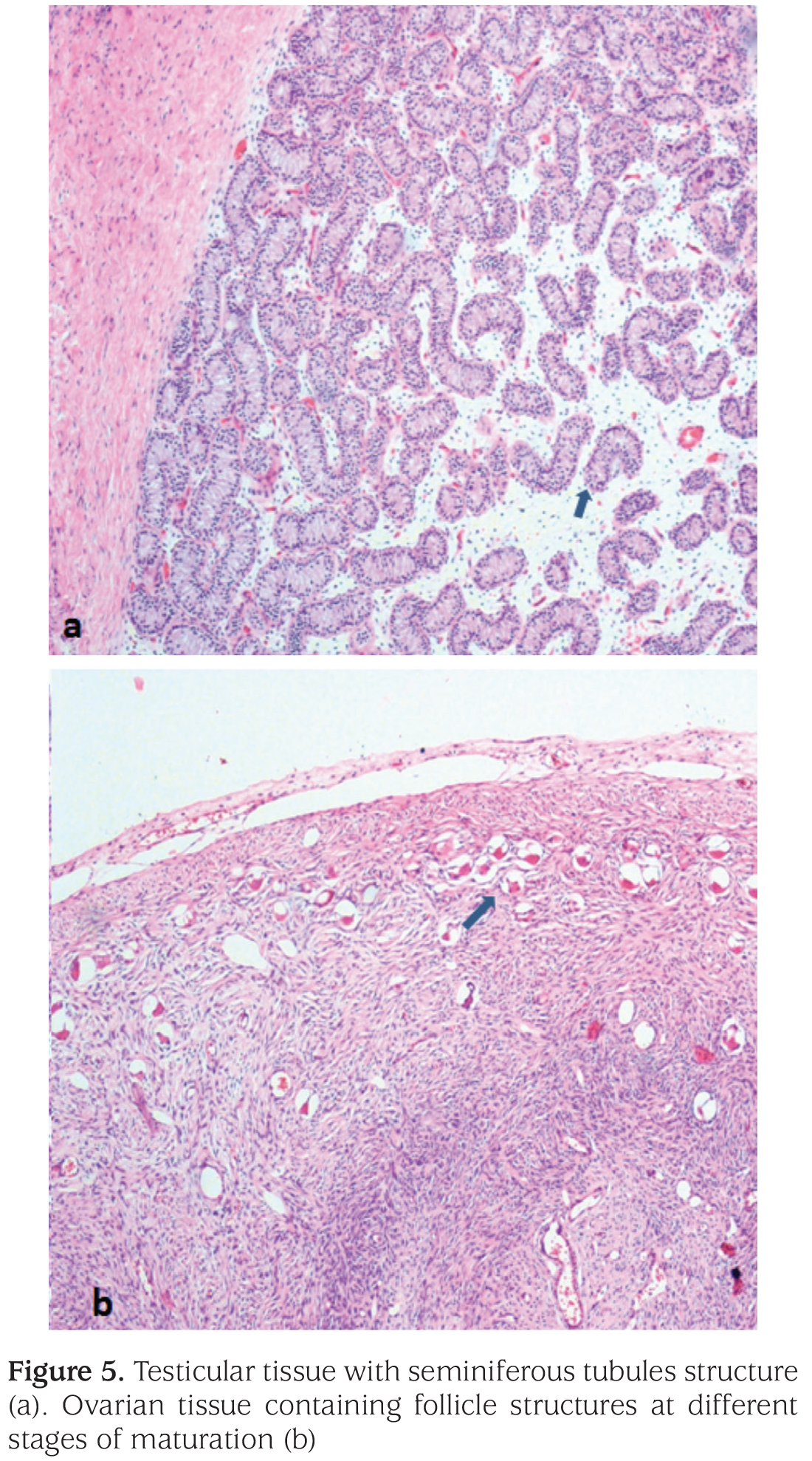 Figure 5