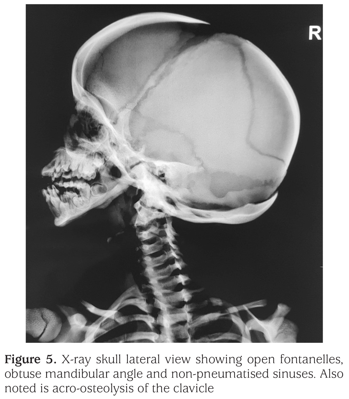 Figure 5