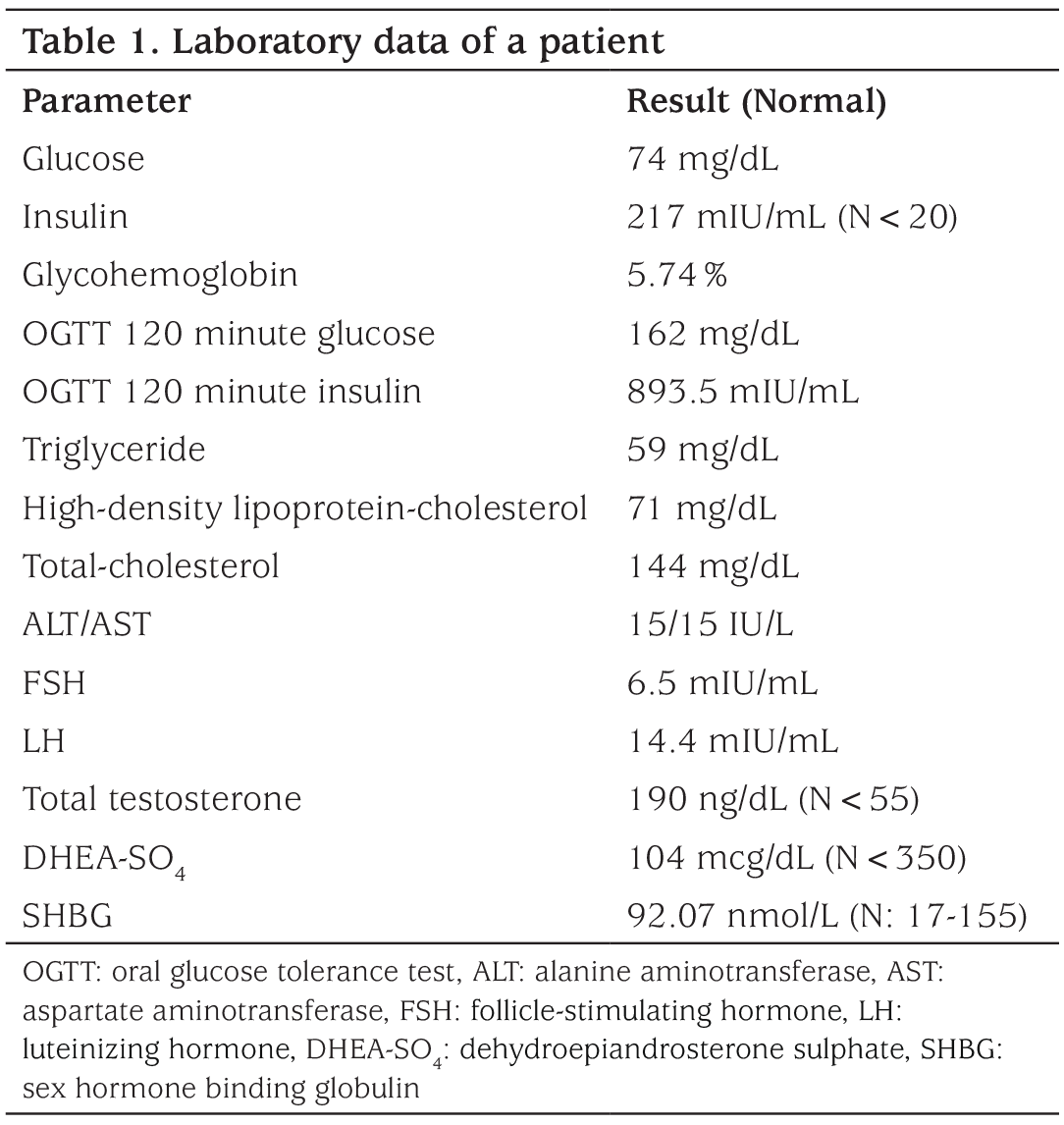 Table 1