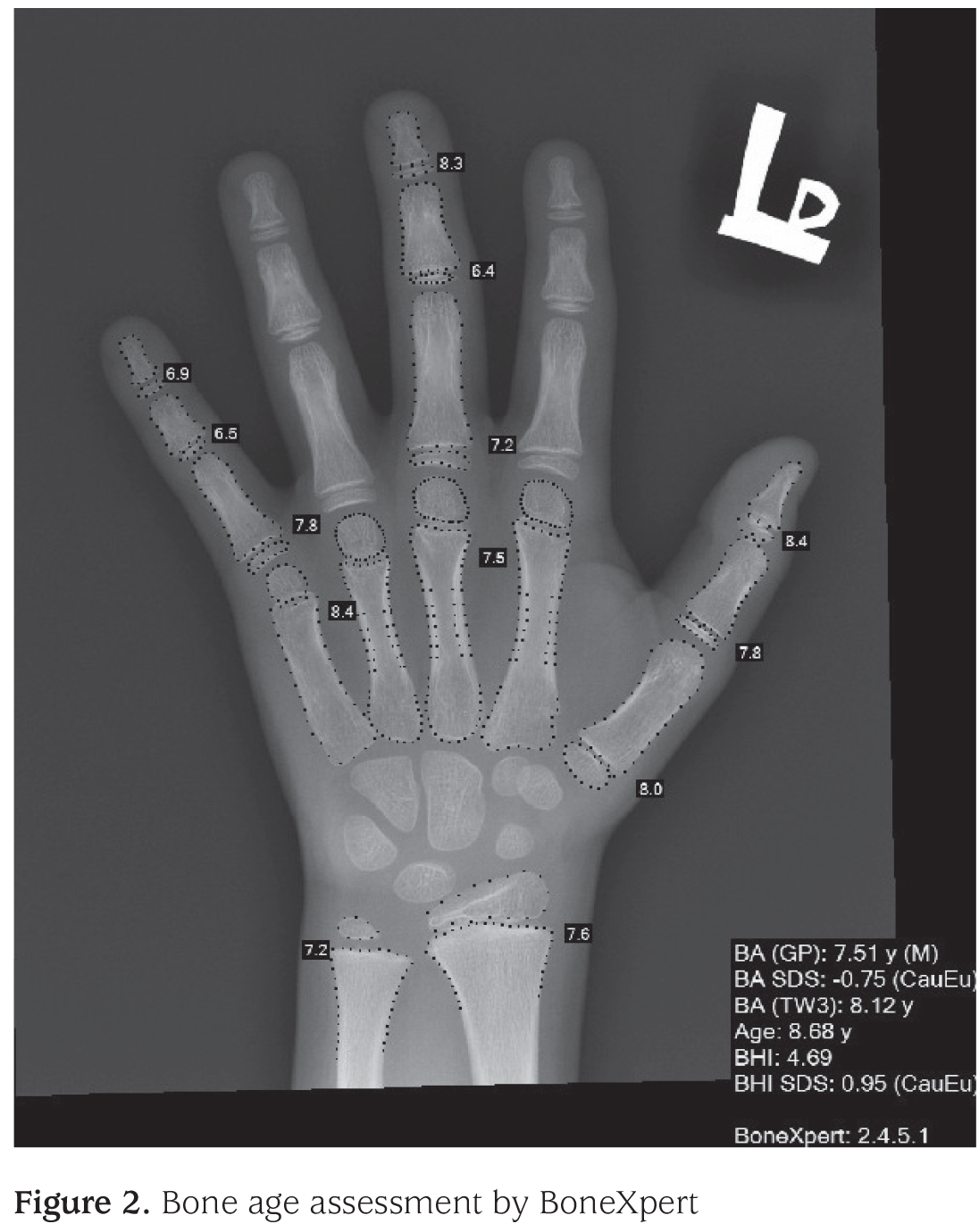 Figure 2